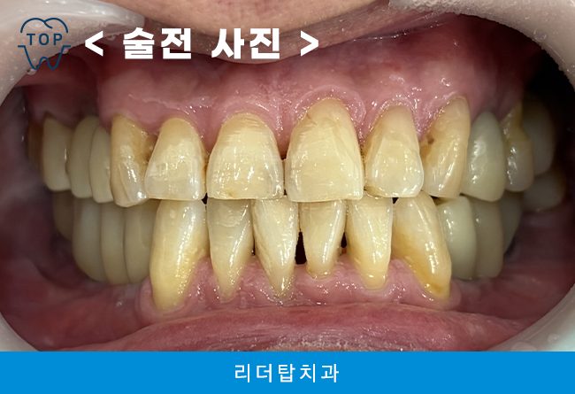 인천서구치과 