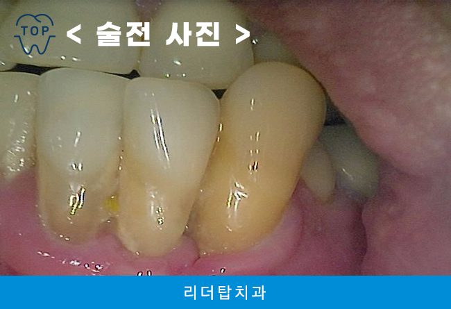 가정동치과 