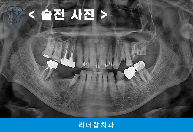 인천서구치과
