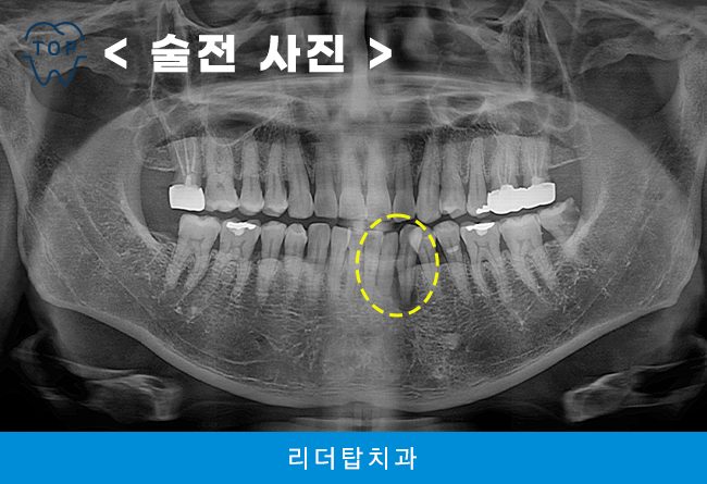 가정동치과 