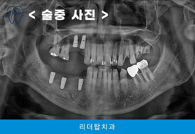 인천서구치과