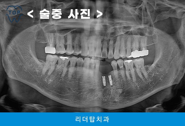 가정동치과 