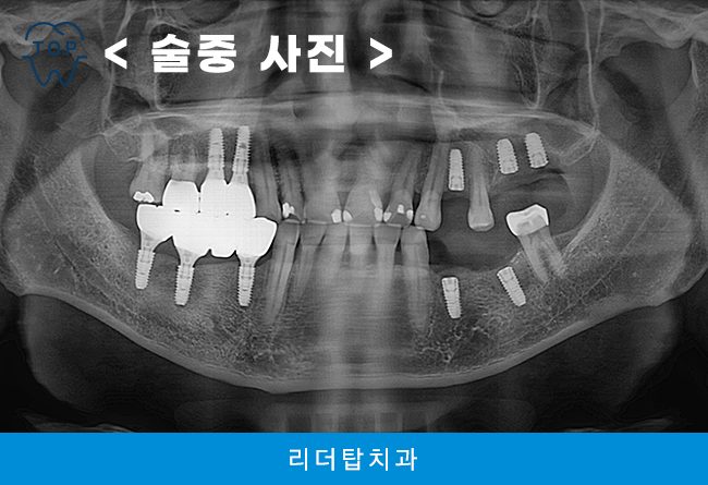 인천서구치과