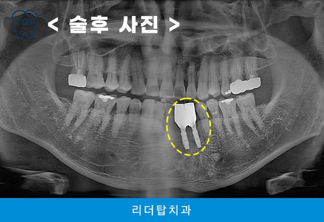 가정동치과 