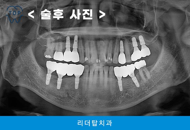 인천서구치과