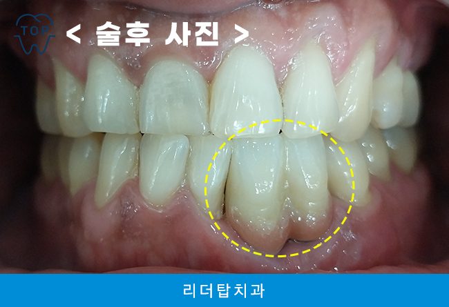 가정동치과 