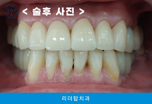 인천서구치과 