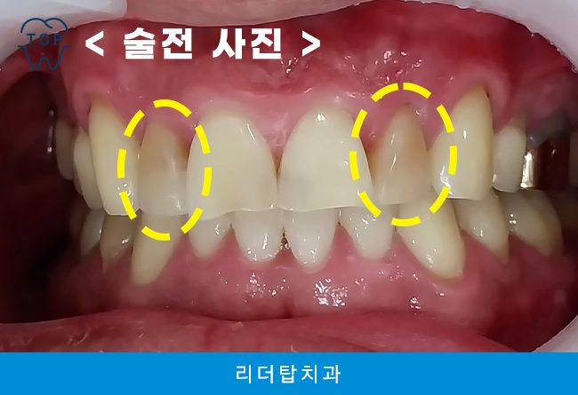 가정동치과 