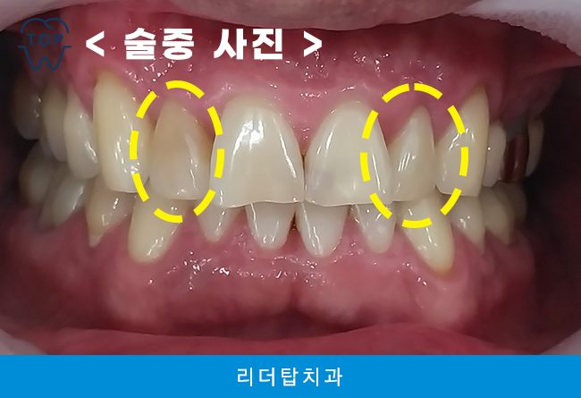 가정동치과 