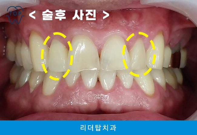 가정동치과 