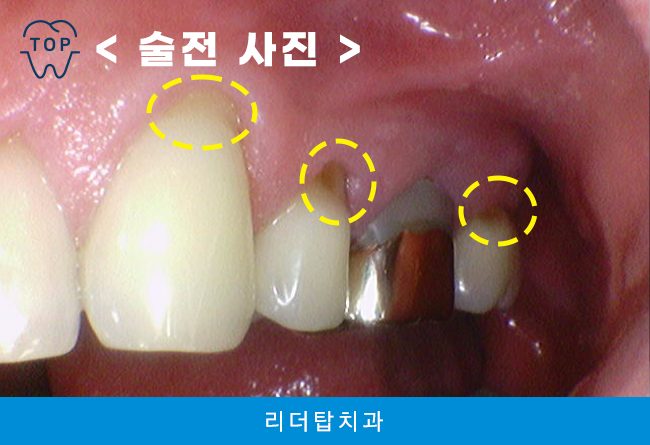 가정동치과 
