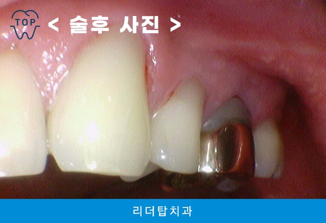 가정동치과 